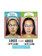 小顔整体研究所 KSラボ 新潟中山店/