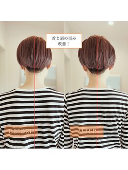 サンテリア(Santelia)/左右の非対称の悩み、身体の歪み