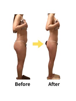 ムーロ(muro.)/Before After