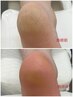 2回目以降 【本格的つるつる角質ケア】45分~90分 5000円~