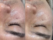 ビーマジック(Be Magic)/メンズフェイシャル！