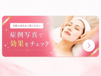 オービーエム 福岡天神三越店(O.B.M)/症例写真