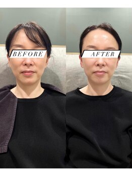 シロ(silo.)/スペシャリティケア