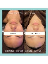 ジュネラ ボーテ(Jenela beaute)/美肌育成＋エイジングケア