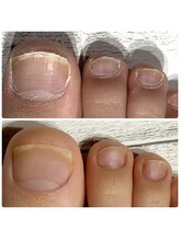 ユキネイル(YUKINAIL)/【ネイルケア】