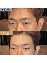 眉毛ハウス 吉祥寺店(眉毛HOUSE)/お客様の施術例(吉祥寺/東京)