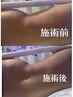 キャンペーン中★ダイエット痩身・完全個室スペシャル・男性女性100分15000円