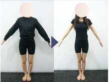 美デザイン 広島並木通り店(美.design)/☆美脚Ｏ脚+美尻骨盤+お腹くびれ