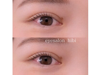 ヒビ(hibi)の写真