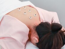 美容鍼灸salonまつもと