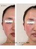 【必見☆直前に小顔と輝くお肌へ】すぐに効果を実感！/お任せんプラン　90分
