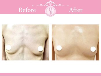 デミーナ(Demyna)/