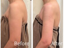 ミント(Mint)の雰囲気（本気で痩身したい方へ。特化技術で“細い”二の腕叶えます！）