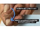 手の巻き爪もお任せください！
