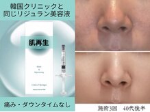 ジェリー(JERRY)の雰囲気（綺麗な毛穴をキープする再生ケアで角栓・黒ずみを戻りにくい肌に）
