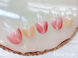 チューリップフレンチ