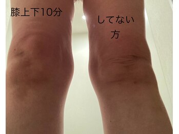 サロン ザファースト(Salon THE First)/winback4膝上下10分美人膝小僧