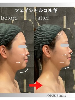 オーパス ビューティー(OPUS Beauty)/ゼロコルギフェイシャル小顔体験