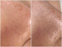 アウラプラス(Aura+)/