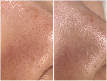 アウラプラス(Aura+)/