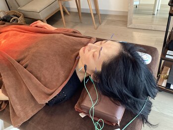 ハリファ鍼灸院 横浜関内院(HariFa鍼灸院)/美容施術