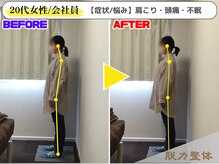 幸せのもり整体院/【20代女性／会社員】Uさん