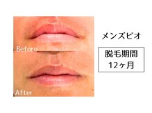 メンズビオ 神戸三宮店/