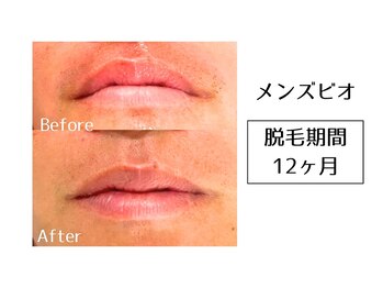 メンズビオ 神戸三宮店/