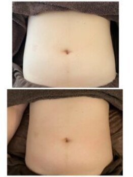 フェリームー(feerie mu)/集中シェイプ