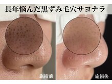 クイーナクルー(QUEENA CLUE)