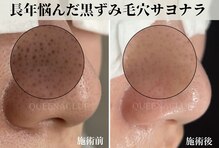 クイーナクルー(QUEENA CLUE)