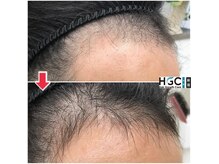 自毛を活かして、豊かな美髪に！フェイクでない本物の髪で勝負！