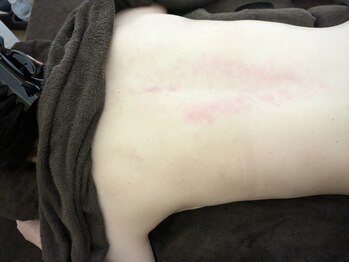 リデザイン 京都(REDESIGN)/REDESIGN京都中医施術法