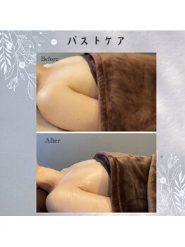 リリー(Lily)/ビフォーアフター