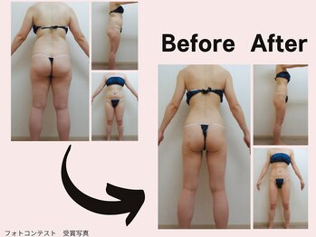 ミネルバエンダモロジー/エンダモロジー/痩身/ウェルネス