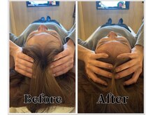 整体ラルース 中目黒(LALUZ)/20代 女性 小顔ヘッドスパ 変化