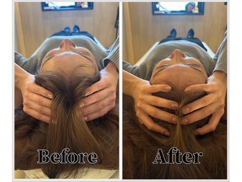 整体ラルース 中目黒(LALUZ)/20代 女性 小顔ヘッドスパ 変化