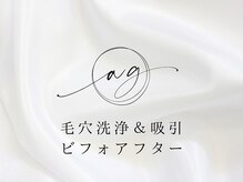 アストリエ グレース 相模大野(Astorie Grace)/毛穴洗浄＆吸引の肌変化♪