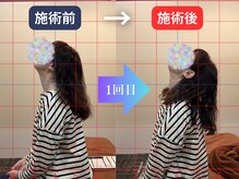 薮下整体院 札幌円山店の雰囲気（初回の施術で変化を実感していただけます。）