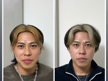 サロンスマイルの雰囲気(美容鍼10回で小顔効果【リンパ/小顔/美容鍼/小顔矯正】)