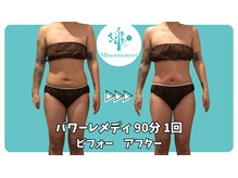 ミノリノモリ(Minorinomori)/パワーレメディ1回