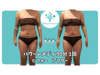 ミノリノモリ(Minorinomori)/パワーレメディ1回