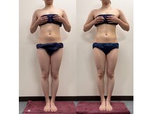 アイリーボーテ 東大阪(アイリーBEAUTE)の雰囲気（施術なし！ホームケア朝・夜1週間足に塗布）