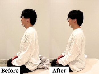 ソレア(Solea)/足腰の重だるさ・背中のハリ