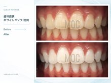 クリアルーティン 熊本宇城(CLEAR ROUTINE)の雰囲気（美容から歯科提携メニューまで、白さに合わせてご提案。）