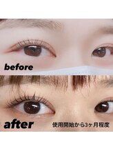 美肌脱毛エステサロン ベール 昭島店/ラッシュアディクト