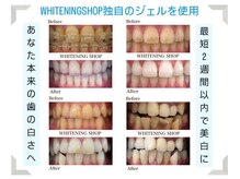 ホワイトニングショップ 一関店/回数を重ねるほどトーンアップ