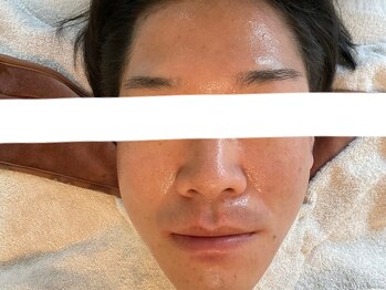 リセットプラス(Reset+)/