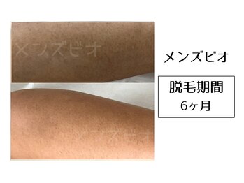 メンズビオ 神戸三宮店/