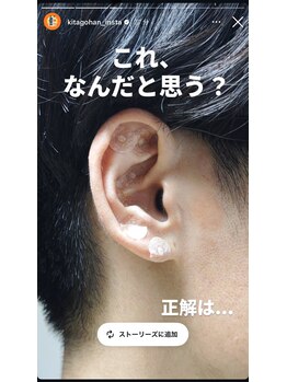さっぽろ心灯はり・きゅう院/「きたごはん」さんもご来院!